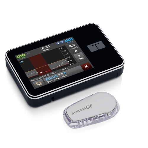 ndss dexcom